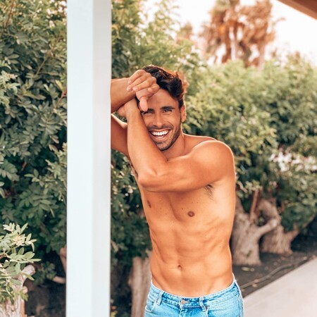 Noel Bayarri ('MyHyV') cae en la tentación de los retoques estéticos faciales: este es el resultado de su operación