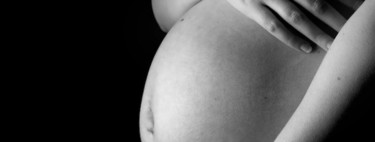 Pregunta a la matrona:  ¿Qué es y cómo solucionar la diástasis de los rectos abdominales?