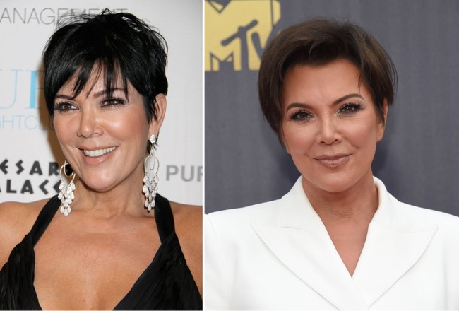 Kardashian Cirugia 05