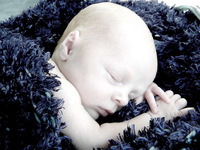 El extraño caso del bebé que nació con sangre blanca 