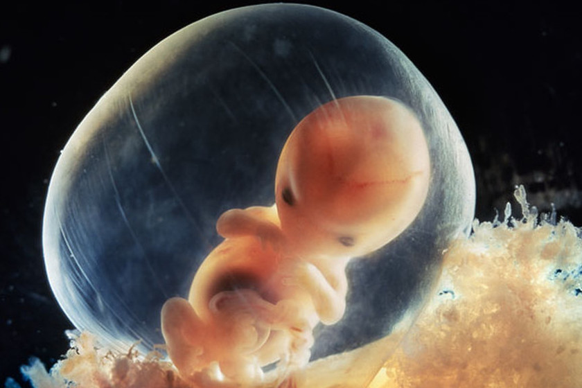 Espectaculares Imagenes De La Concepcion Y El Embarazo Semana A Semana