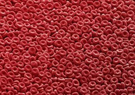 ¿Qué está pasando cuando orinamos sangre después de un entrenamiento?