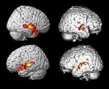 ¿Existe consciencia durante el estado vegetativo?