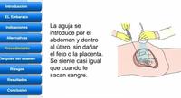 Tutorial interactivo sobre la amniocentesis