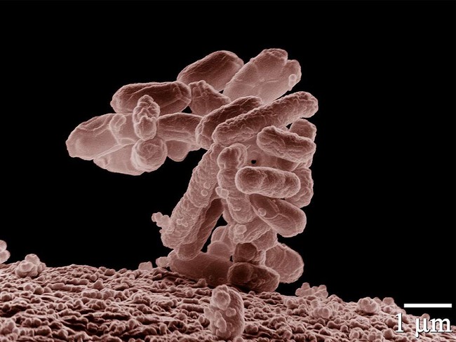 Ecoli