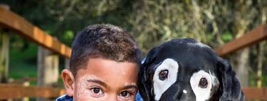 La preciosa historia de un niño con vitiligo y un perro unidos por la misma enfermedad