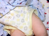 Un brote de sarampión en Rute obliga a vacunar a todos los bebés mayores de seis meses