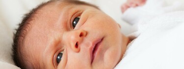 Plagiocefalia posicional o postural en el recién nacido: cómo prevenir la deformidad de la cabeza del bebé
