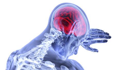 Ictus cerebral: causas, síntomas y tratamiento