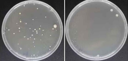 Bacteria Llaves Coche