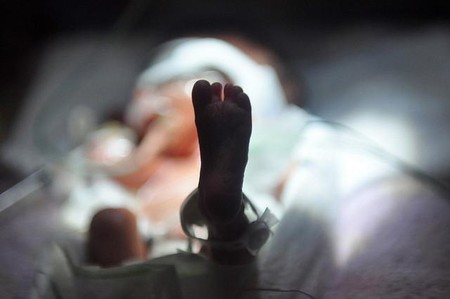 Con 75 años y un solo pulmón, una mujer india dio a luz a una bebé prematura de 600 gramos