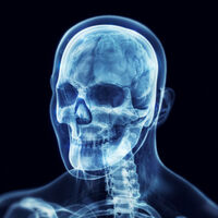 Esta condição genética rara funciona quase como uma Akuma no Mi — grandes vantagens físicas, mas nadar se torna algo extremamente perigoso 