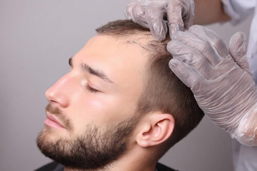 La cura para la calvicie está a una DeSci alejada de las farmacéuticas de distancia: eso cree la comunidad que se junta en Discord para encontrarla