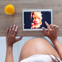 La estafa de las ecografías 5D: acusan a una clínica de dar a todas las embarazadas la misma imagen de sus bebés  