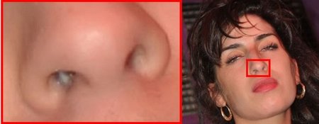 Amy Winehouse, recuperada de narices