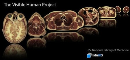Proyecto Humano Visible: la primera referencia visual detallada del interior humano está basado en un criminal