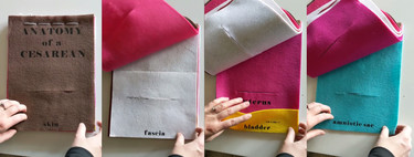 "Anatomía de una cesárea", el vídeo viral que muestra de forma práctica cómo se realiza esta importante cirugía