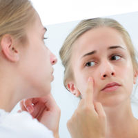 Mi hijo adolescente tiene acné y le afecta psicológicamente: qué hacer para ayudarle
