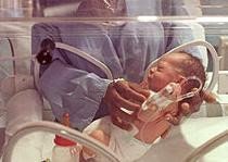 Bebés prematuros pueden sentir dolor