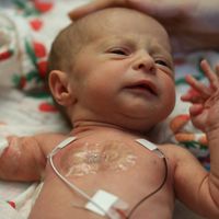 Escuchar música ayudaría a mejorar el desarrollo cerebral de los bebés prematuros