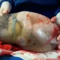 El fascinante vídeo de un bebé que nace dentro de la bolsa y se mueve sin saber que ya está aquí