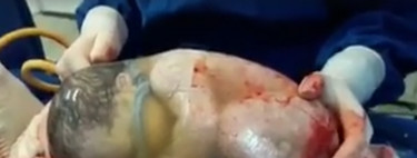 El fascinante vídeo de un bebé que nace dentro de la bolsa y se mueve sin saber que ya está aquí