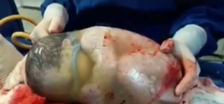 El fascinante vídeo de un bebé que nace dentro de la bolsa y se mueve sin saber que ya está aquí