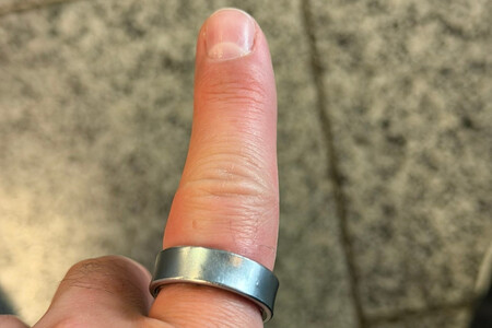 Samsung Galaxy Ring Dedo Hinchado