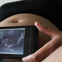 Semana 21 de embarazo: comienza la segunda mitad de la gestación