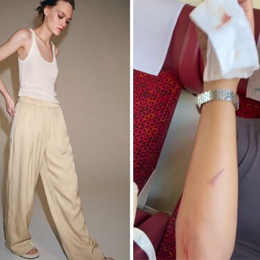 Para irte de fiesta y terminar en el hospital: los pantalones asesinos de Zara que están causando heridas, caídas y huesos rotos