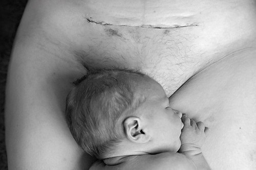 El poema sobre la cesárea que está removiendo sentimientos y ayudando a miles de mujeres