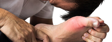 Niveles altos de ácido úrico perjudican gravemente la salud: siete causas que lo aumentan y no lo sabes. 