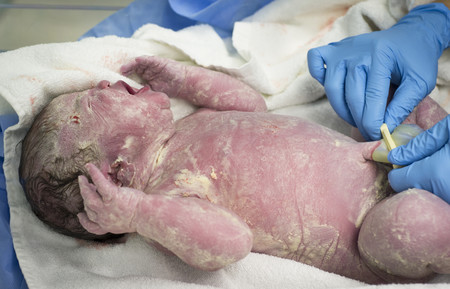 Los bebés no nacen sucios: el primer baño puede esperar
