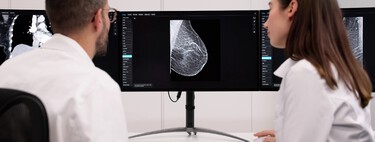 Testada com 105 mil mulheres, inteligência artificial atua como segunda leitura em mamografias e ajuda a identificar o câncer de mama precocemente 