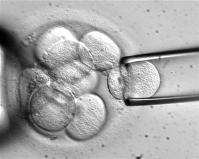 Diagnóstico genético preimplantación por fin en España