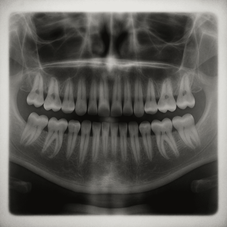 Dentalx Ray