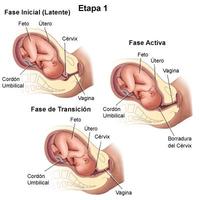 Guía del Plan de Parto (Dilatación)