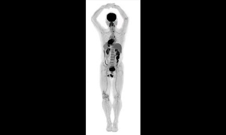 Estas son las imágenes del primer escáner de cuerpo entero del mundo