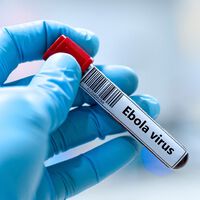 “Não há vacina licenciada ou terapia específica” — o que mudou do último surto de Ebola para o de 2026?  