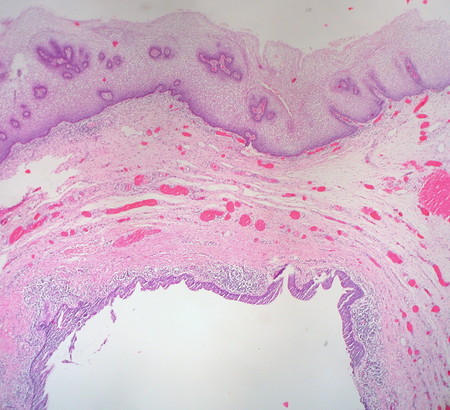 No existe una vagina "normal", según este estudio sobre las susodichas