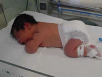 Nace bebé con 1.2 grados de alcoholemia