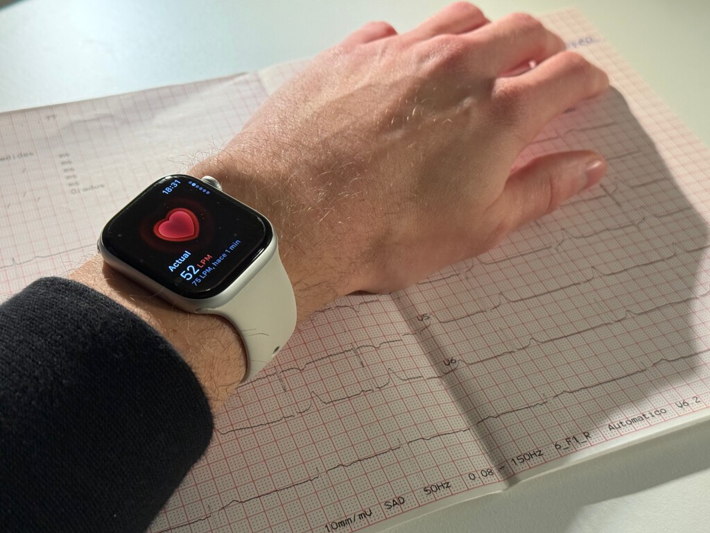El 57% de los pacientes se sentían bien. El Apple Watch descubrió un problema grave que los chequeos médicos pasaron por alto 