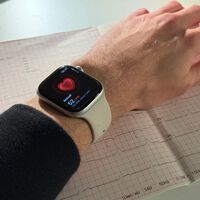 El 57% de los pacientes se sentían bien. El Apple Watch descubrió un problema grave que los chequeos médicos pasaron por alto 