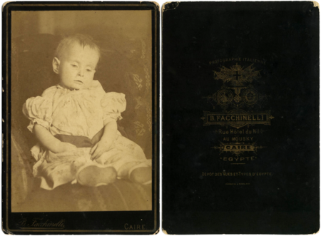 Post Mortem Infant By Facchinelli C1890