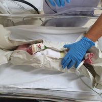 La técnica pionera sin sedación para hacer resonancias a los bebés con un colchón de vacío