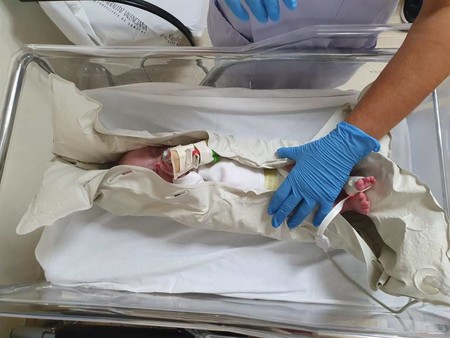 La técnica pionera sin sedación para hacer resonancias a los bebés con un colchón de vacío