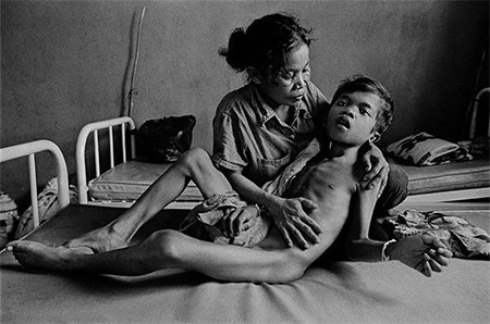 La tuberculosis, vista por James Nachtwey