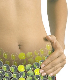 Sindorme de ovarios poliquisticos