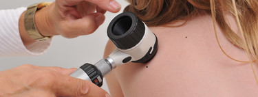 Moluscos infecciosos: una de las enfermedades dermatológicas más frecuentes en la infancia