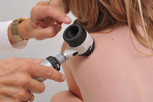 Moluscos infecciosos: una de las enfermedades dermatológicas más frecuentes en la infancia